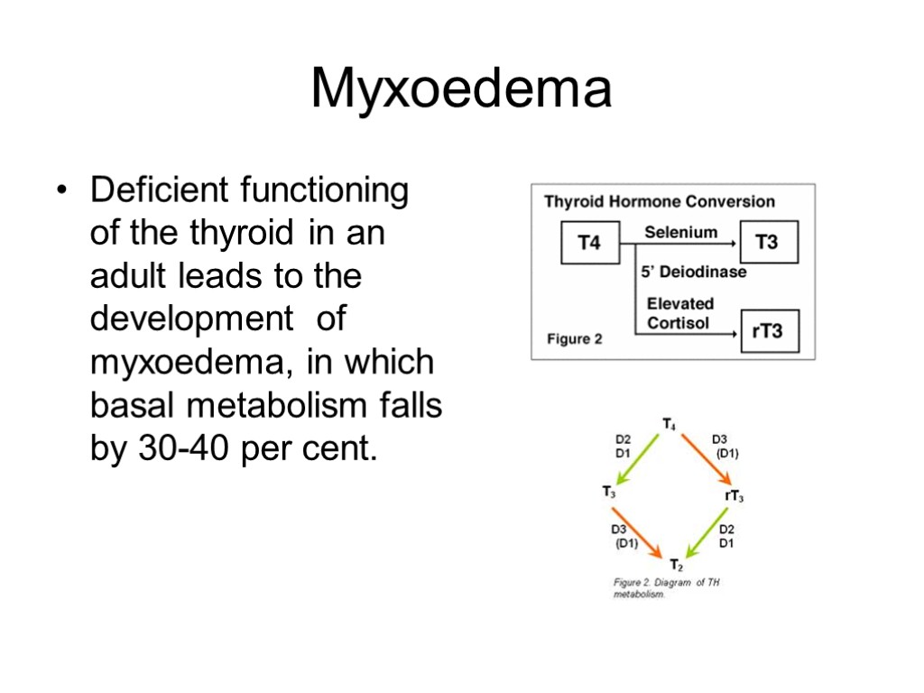 Myxoedema Deficient functioning of the thyroid in an adult leads to the development of